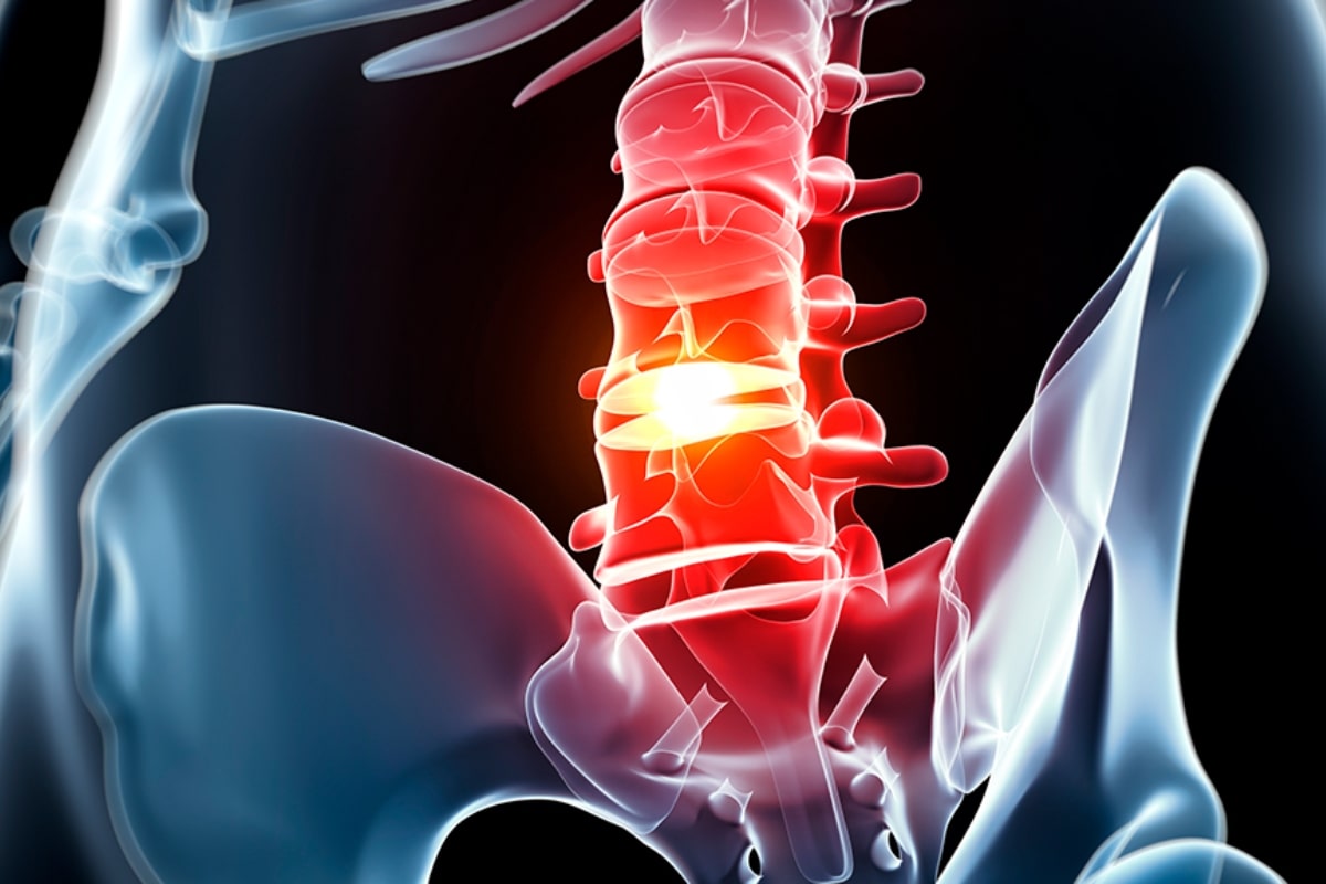 everything-you-need-to-know-about-degenerative-disc-disease