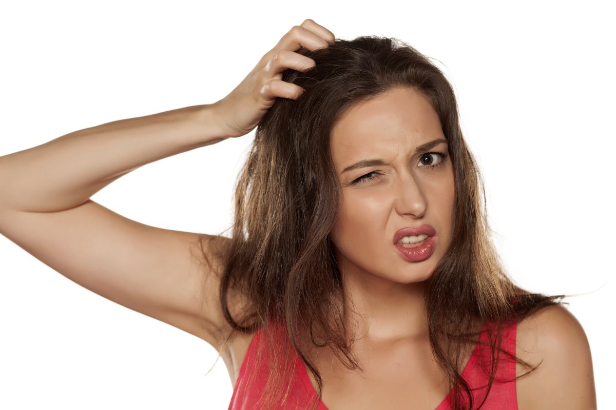 Dandruff Treatment at Home: How to Get Rid of Flakes Naturally